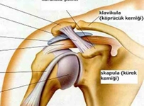 Kas Sıkışması Belirtileri ve Tedavisi