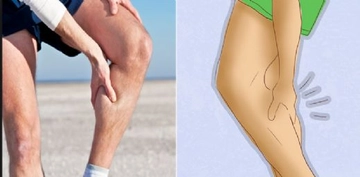 Kas Zedelenmesi Belirtileri ve Tedavisi